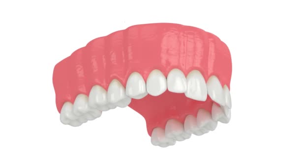 牙齿位置不正常 牙齿矫正治疗的概念 — 图库视频影像