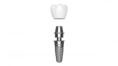 Beyaz arkaplan üzerinde diş implantı kurulumu