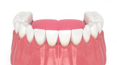 Açık gingival embrasure ile insan alt çene