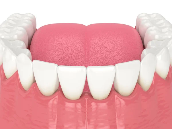 Renderização Mandíbula Inferior Humana Com Triângulos Pretos Entre Dentes — Fotografia de Stock