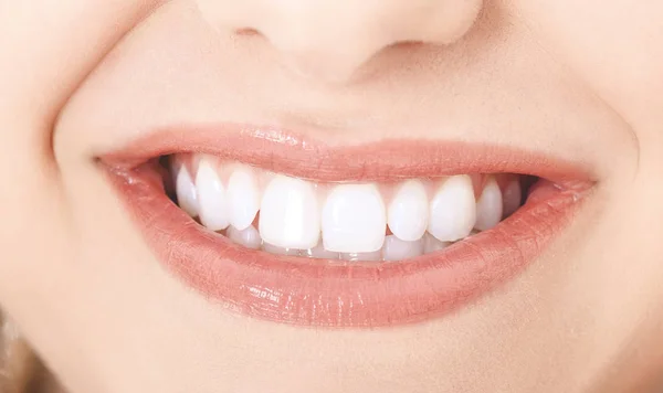 Sonrisa con dientes blancos — Foto de Stock