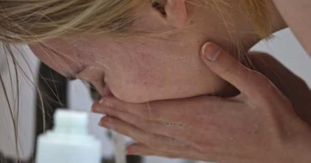 Behandlung der Akne-Haut — Stockvideo