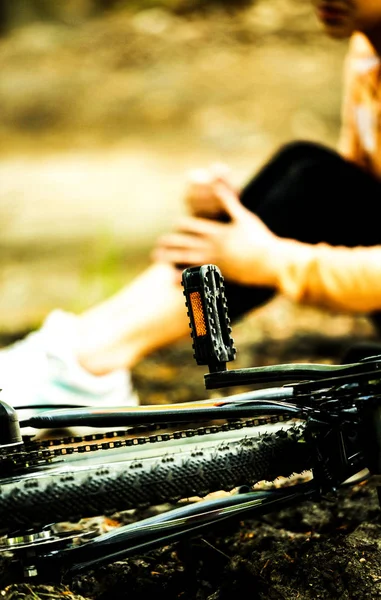 Biker with injured leg — Stock Photo, Image