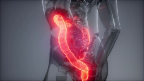 Human Colon Radiology Exam — Stock Footage Human Colon Radiology Exam Stock Video