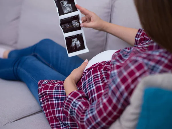 Mujer Embarazada Joven Mirando Foto Ultrasonido Del Bebé Mientras Relaja — Foto de Stock