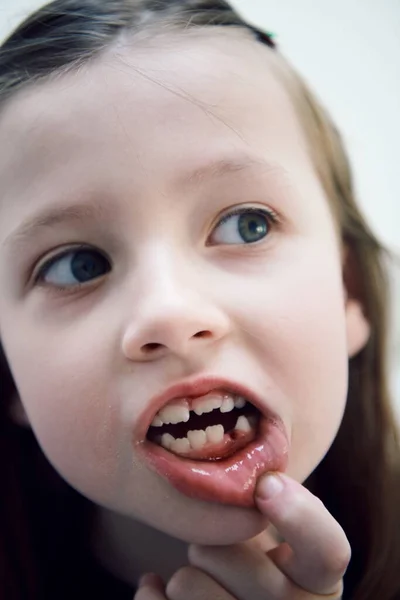 滑稽的小女孩 没有牙齿的笑 差距拉近了 — 图库照片