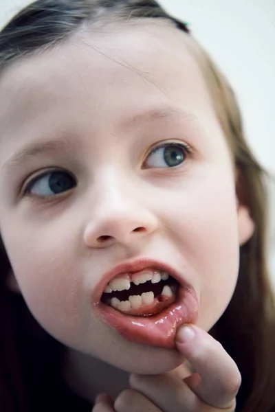 Engraçado Menina Sem Dentes Sorrisos Mostrando Lacuna Perto — Fotografia de Stock