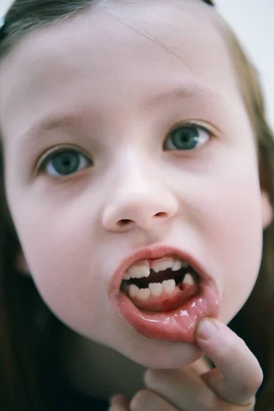 Funny Little Girl Tooth Smiles Showing Gap Close — Stock Photo, Image