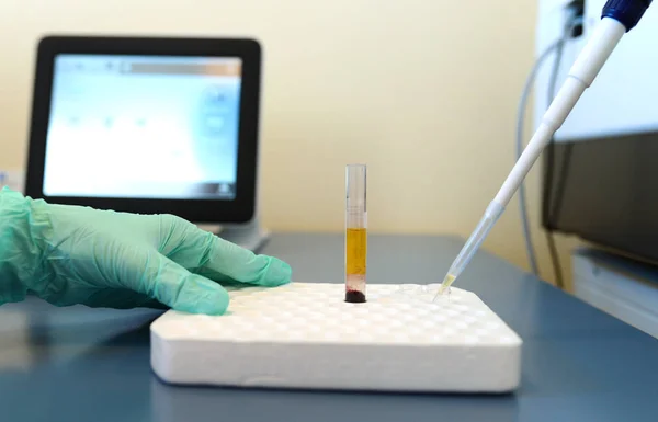 Prueba de bacterias patológicas — Foto de Stock