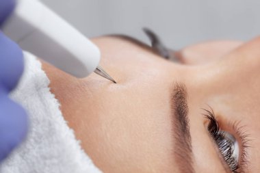 Kozmetik uzmanı, güzellik salonundaki güzel, genç bir kadının yüz derisinin Couperose tedavisini yapıyor. Kozmetoloji ve profesyonel cilt bakımı..