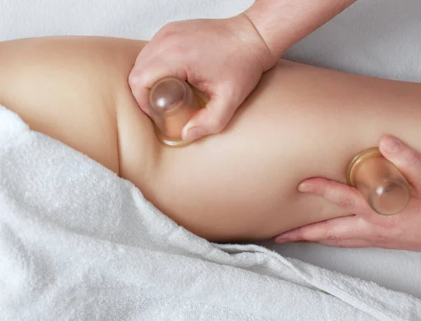 Masseur Maakt Massage Met Potjes Cellulitis Billen Dijen Van Patiënt — Stockfoto