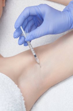 Doktor koltukaltı bölgesinde hiperhidrosite karşı botulinyum iğnesi yapıyor..