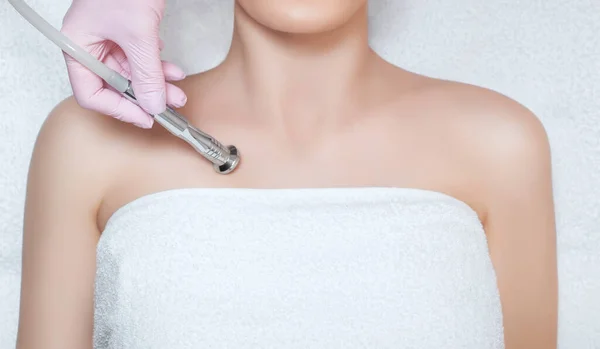 Der Kosmetologe Führt Den Eingriff Mikrodermabrasion Der Haut Einer Schönen — Stockfoto