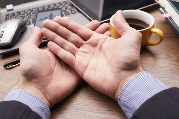 Lege Mannelijke Handen Liggend Kantoor Tafel Business Concept — Stockfoto