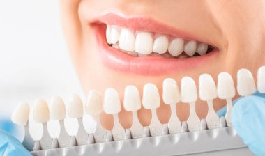 Güzel gülümseme ve genç kadının beyaz dişler. İmplantlar tonları eşleme.