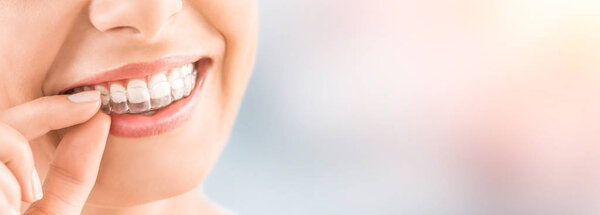 Woman wearing orthodontic silicone trainer, cropped shot