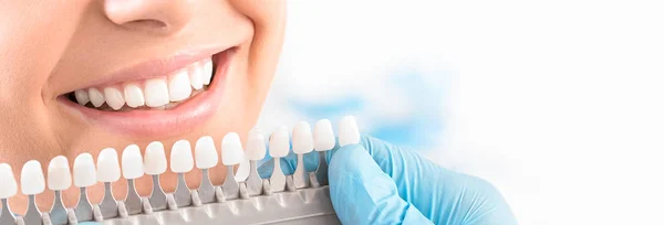 Hermosa Sonrisa Dientes Blancos Mujer Joven Sombras Implantes Juego — Foto de Stock