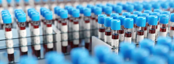 Provette Coronavirus Covid19 Rack Screening Medico Massa Test Covid Concetti — Foto Stock