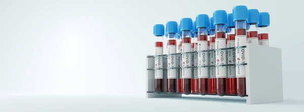Provette Coronavirus Covid19 Rack Screening Medico Massa Test Covid Concetti — Foto Stock
