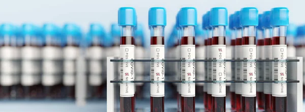 Provette Coronavirus Covid19 Rack Screening Medico Massa Test Covid Concetti — Foto Stock