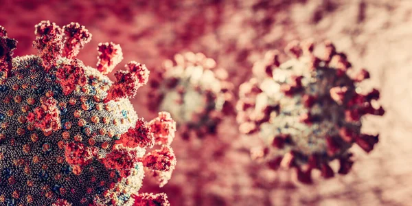 코로나 바이러스 Covid 공격하는 폐렴을 일으키는 코로나 바이러스 — 스톡 사진