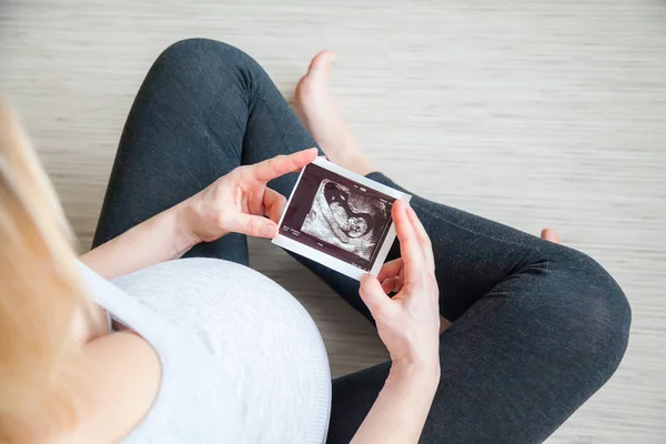 Nepoznání Těhotnou Ženu Při Pohledu Ultrazvukové Vyšetření Svých Rukou — Stock fotografie