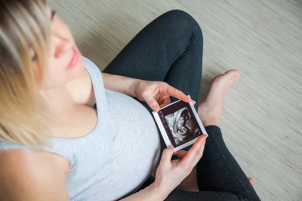 Těhotná Žena Držící Ultrazvukové Vyšetření Ruce — Stock fotografie