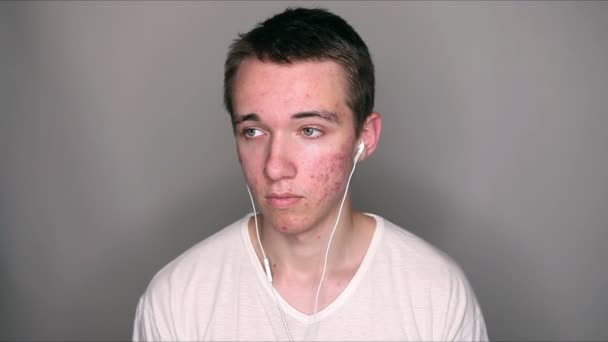 Adolescente Com Acne Ouvindo Música Através Dos Fones Ouvido — Vídeo de Stock