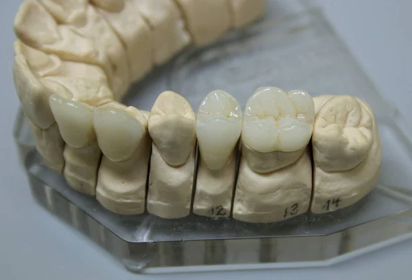 Dental Prosthesis Close Dental Workshop — Stock Photo, Image
