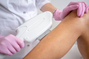 Kadınların bacaklarında lazer tüyü alınır. beyaz arkaplan kapat