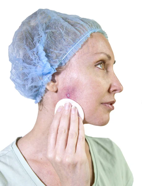Foto Una Serie Cosmetología Complicaciones Mujer Limpia Herida Después Del — Foto de Stock