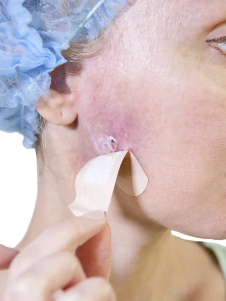 Fotoğraf Bir Dizi Kozmetik Komplikasyonlar Kadın Bir Kürtaj Kaldırma Kötü Stok Fotoğraf
