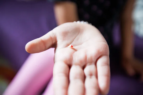 Vista de perto da mão da criança mostrando dentes de leite caídos primeiro — Fotografia de Stock