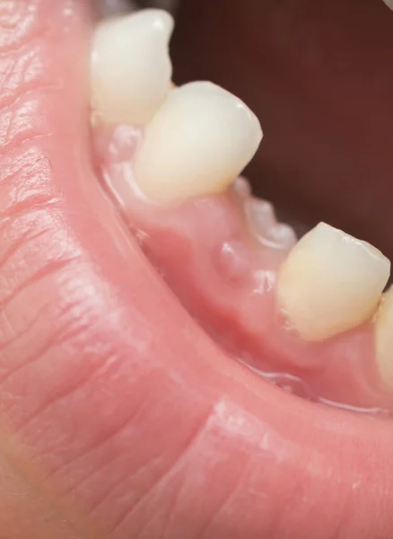 Primo Piano Della Bocca Del Bambino Senza Dente Latte — Foto Stock