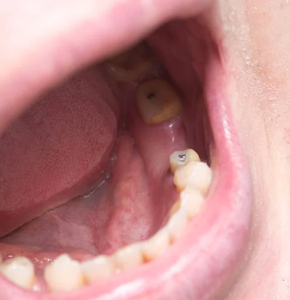 Partie Visage Sans Dents — Photo