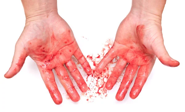 Mãos Sangrentas Isolado Fundo Branco — Fotografia de Stock