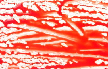 kan beyaz arkaplanda izole edildi