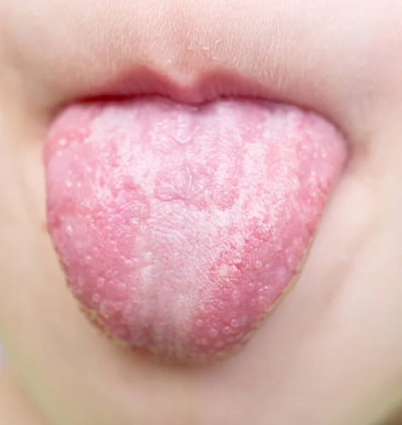 Close Shot Baby Tongue — Stock Photo, Image