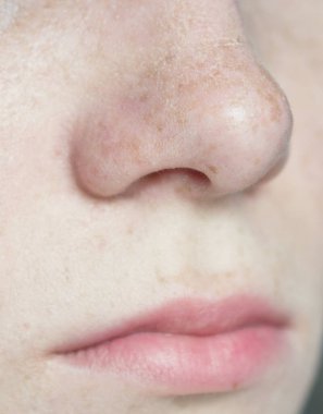 Kadının burun ve dudaklarını yakın plan çek.