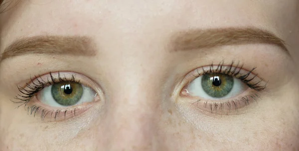 Retrato Mujer Con Ojos Verdes Pecas —  Fotos de Stock