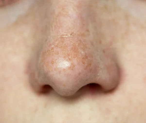 Zblízka Záběr Lidského Nosu — Stock fotografie