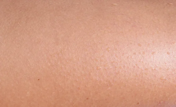 Υγρό Ανθρώπινο Δέρμα Φόντο — Φωτογραφία Αρχείου