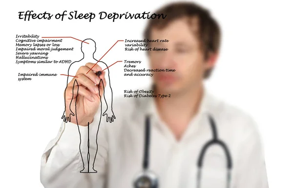 Efectos Privación Del Sueño — Foto de Stock