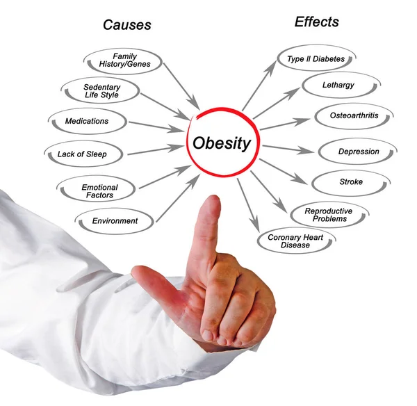 Obesidad Causas Efectos — Foto de Stock