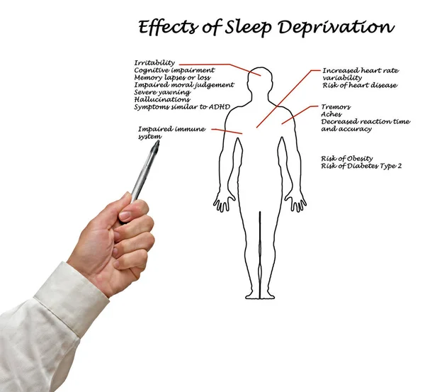 Účinky Nedostatku Spánku — Stock fotografie