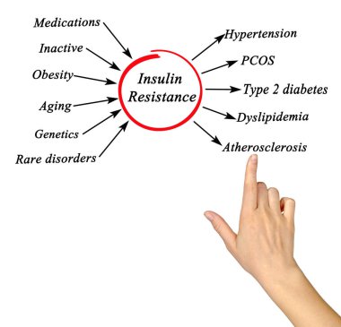 Causes and effects of Insulin Resistance clipart