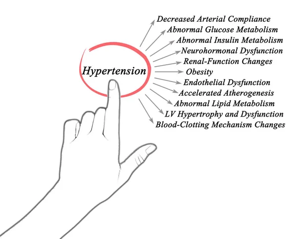 Onze consequências perigosas da hipertensão — Fotografia de Stock