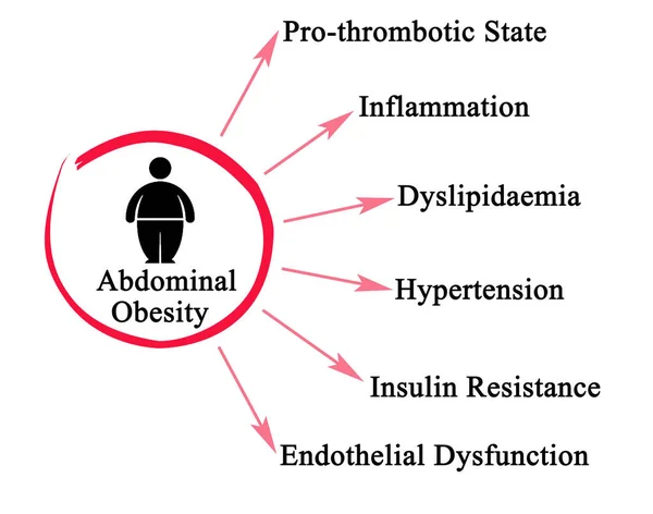 Seis Perigos Obesidade Abdominal — Fotografia de Stock