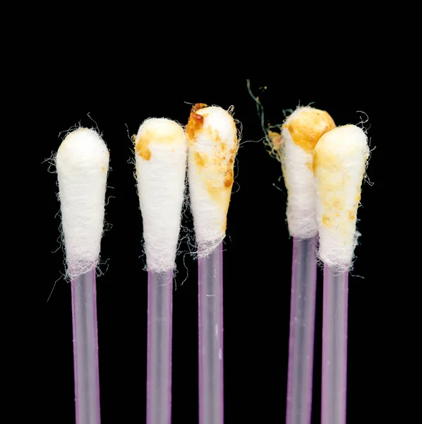 Ear wax on a cotton swab, cerumen