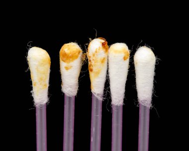 Kulak balmumu bir pamuklu çubukla üzerinde cerumen